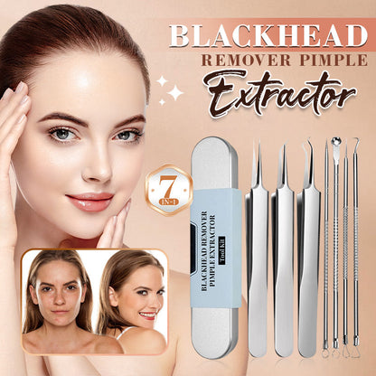 🔥HOT SALE 50% OFF-Stainless Steel Blackhead Remover Tool Kit
