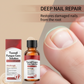 🔥BUY 1 GET 1 FREE!!💅Nail Repair Essence for Damaged Nails Strengthen Weak Cracked Split Nails Cuticle Treatment Oil