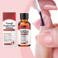 🔥BUY 1 GET 1 FREE!!💅Nail Repair Essence for Damaged Nails Strengthen Weak Cracked Split Nails Cuticle Treatment Oil