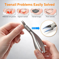 Stainless Steel Ingrown Toenail Clipper and Dead Skin Nipper 2 Piece Manicure Set